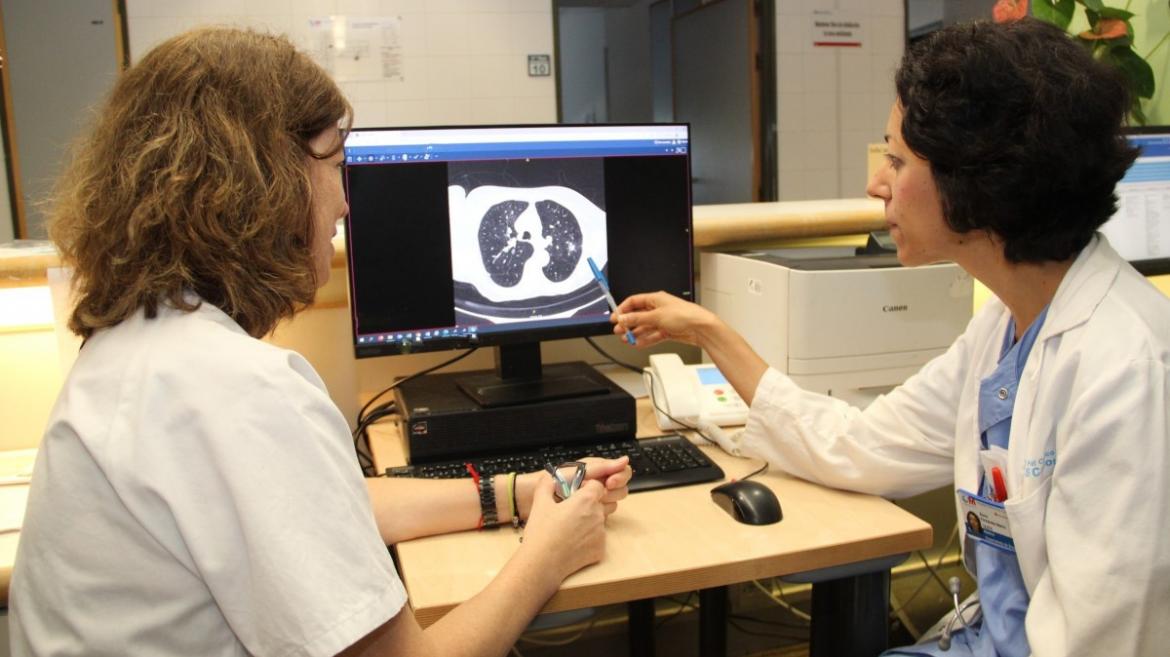 Clínico San Carlos de Madrid busca pacientes para estudio de detección temprana de cáncer de pulmón