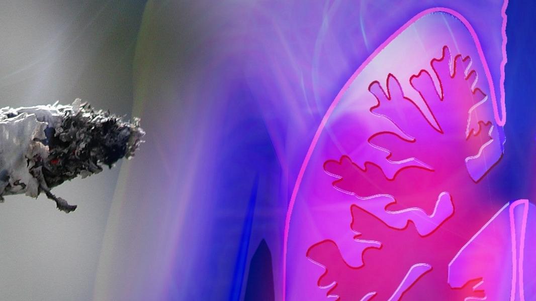 La Comunidad de Madrid lidera un proyecto europeo de medicina de precisión para combatir el cáncer de pulmón