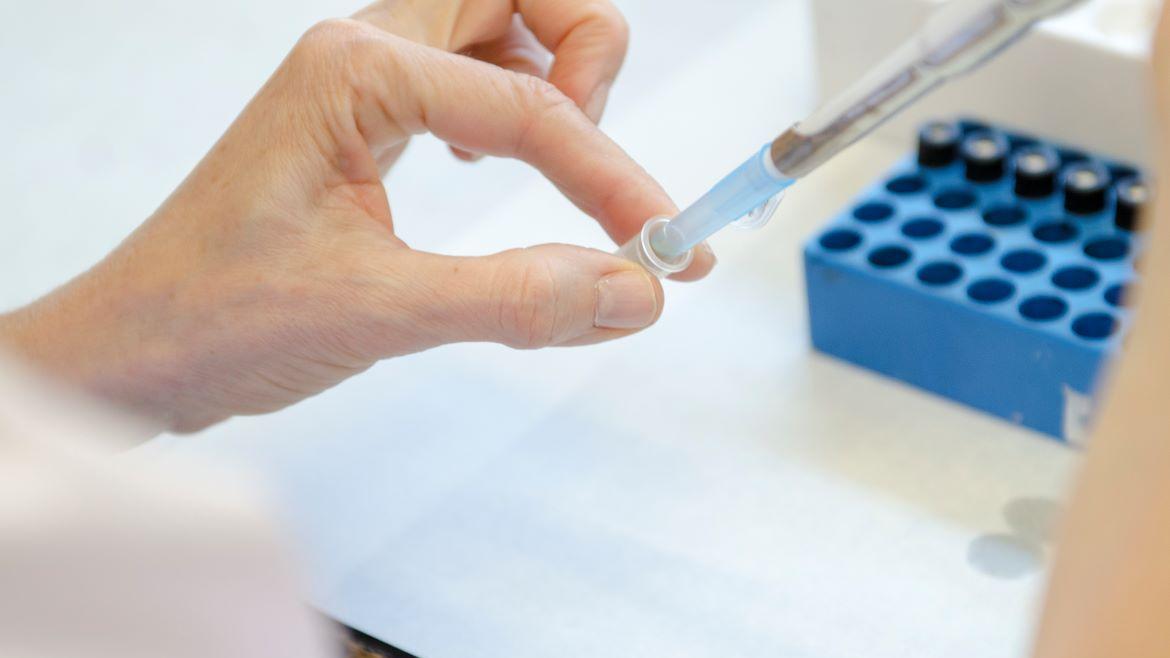 Avances en el diagnóstico de la tuberculosis pediátrica: Biomarcadores plasmáticos del Hospital Gregorio Marañón