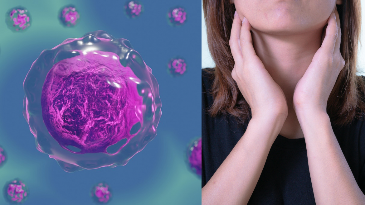 Encuentro bilateral España-Polonia sobre cáncer de laringe en el Hospital público Ramón y Cajal: ¿Qué se discutió?