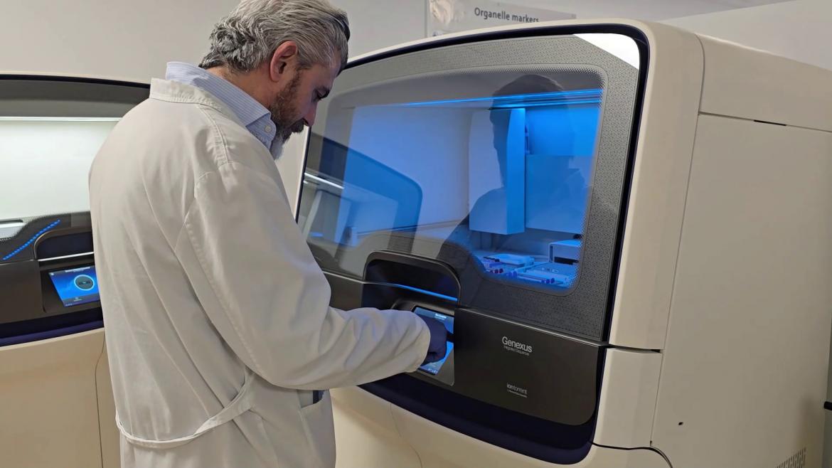 El Hospital público 12 de Octubre revoluciona el tratamiento del glioblastoma con análisis genético de ARN
