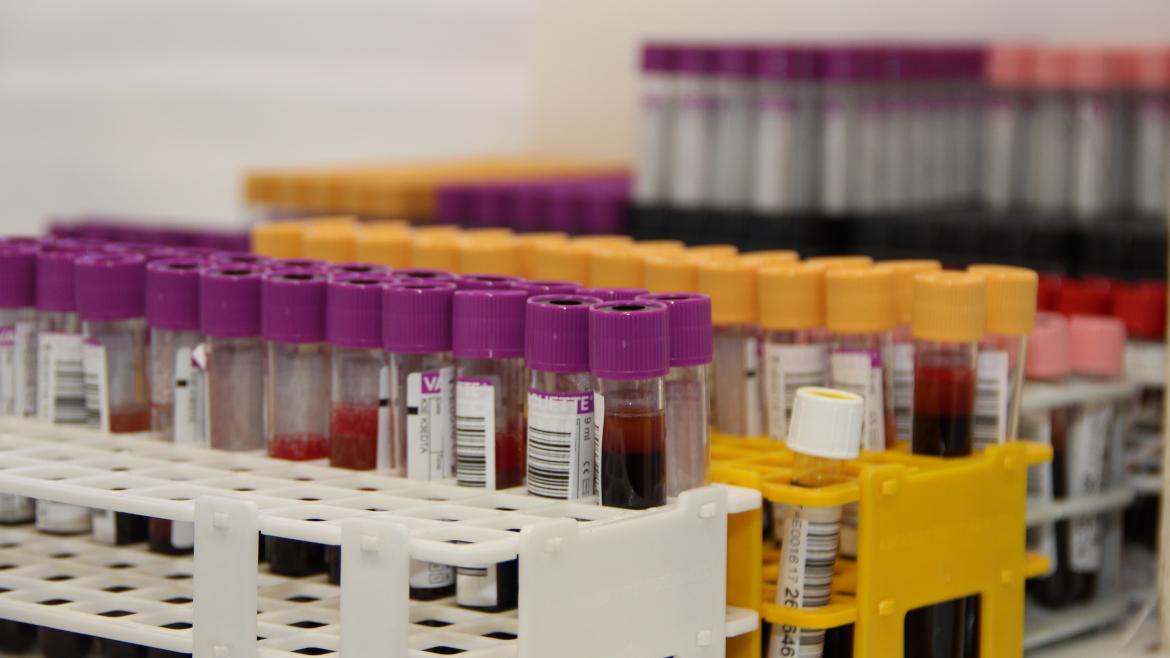 Descubre la innovadora iniciativa del Hospital Clínico San Carlos para el tratamiento de la hipereosinofilia